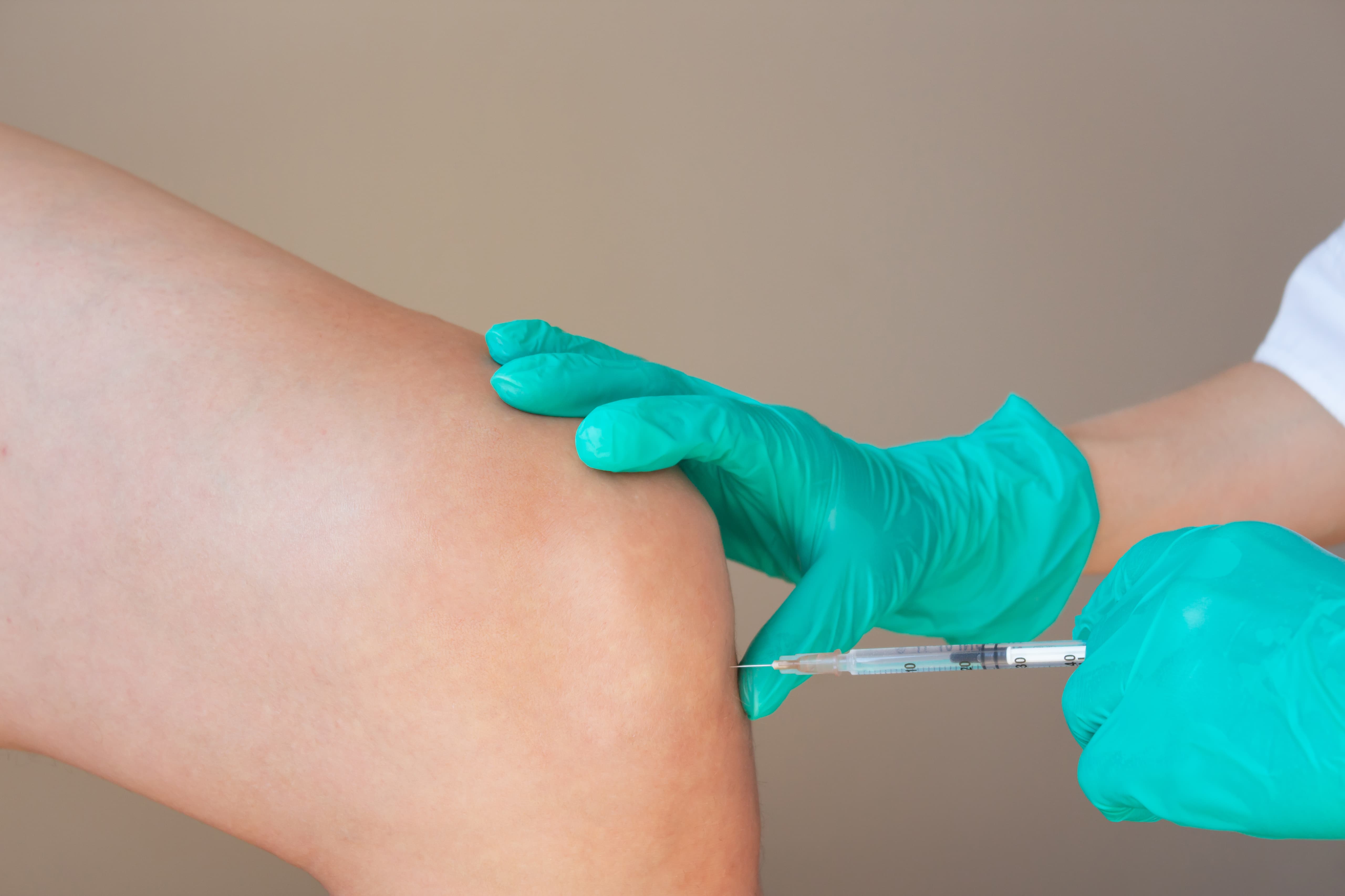  Intra-Articular Injection