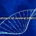Treatment of cerebral infarction